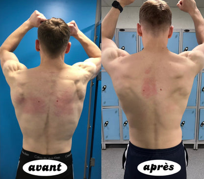 Dossana | Redresseur de Dos à Action Immédiate