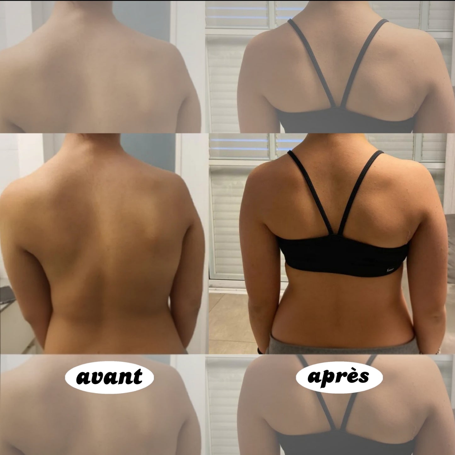 Dossana | Redresseur de Dos à Action Immédiate